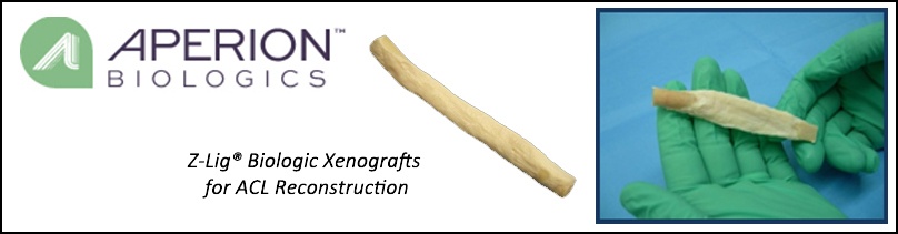 Aperion-header-key-points.jpg